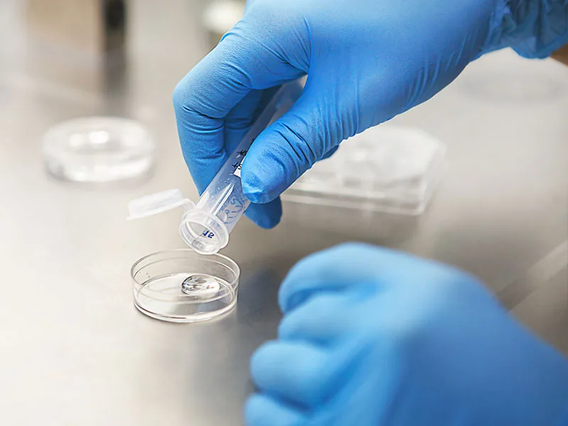 Ankara Sperm Testi